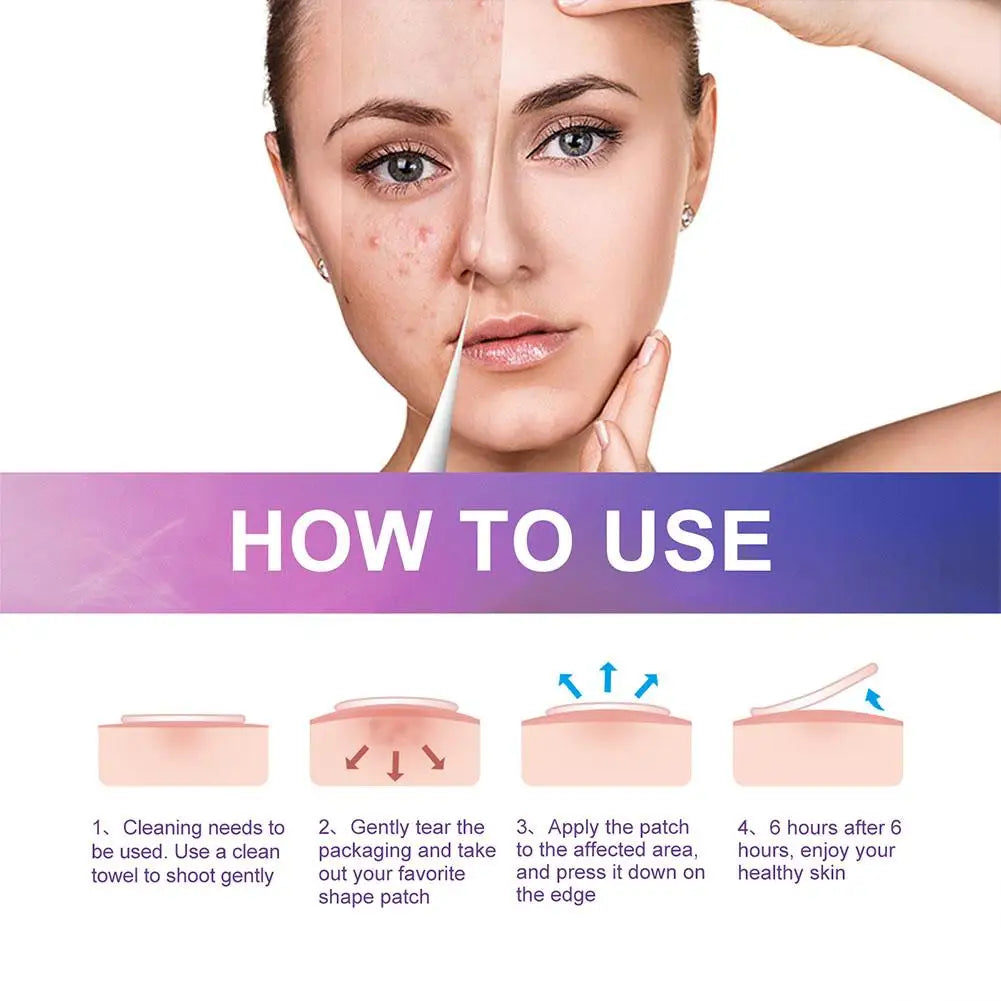 180pc/Box Mini Star Invisible Acne Removal Pimple Patch Beauty Face Acne Spot Face Pimple Acne Skin Concealer Tool Stickers