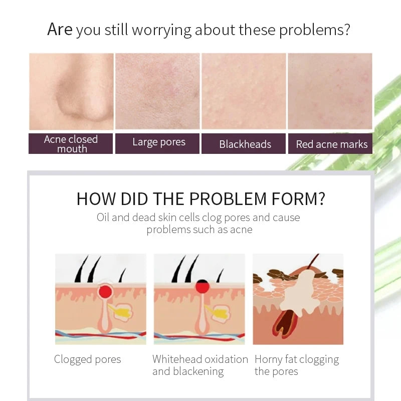 150ml AHA Body Serum Face Brightening Alpha Hydroxy Acids Vitamin C Vitamin E moisturizing Fruit Acid Repair Essence