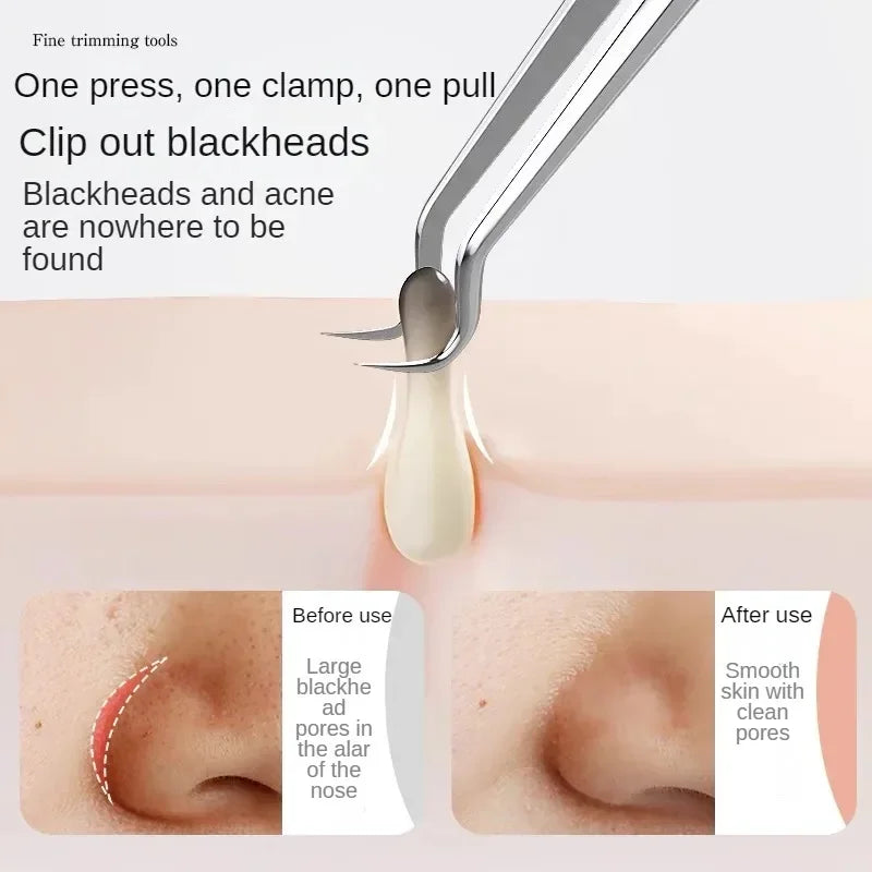 Acne needle blackhead acne remover female skin care beauty acne pores face cleansing blackhead acne needle skin care tool