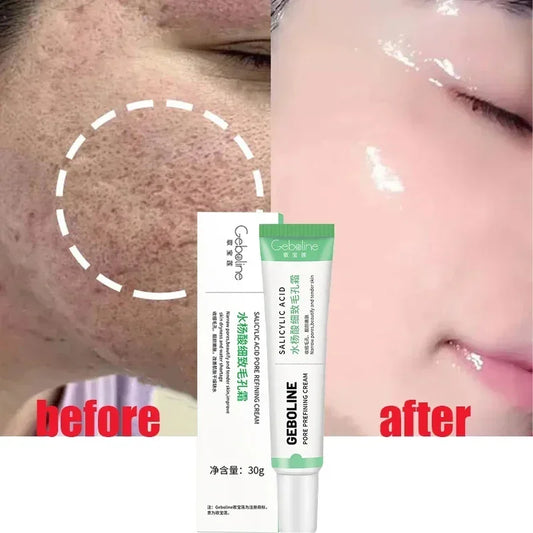 Salicylic Acid Pore Shrinking Cream Quick Remove Blackehead Tighten Face Smooth Skin Elimination Pores Korean Care Product 2024