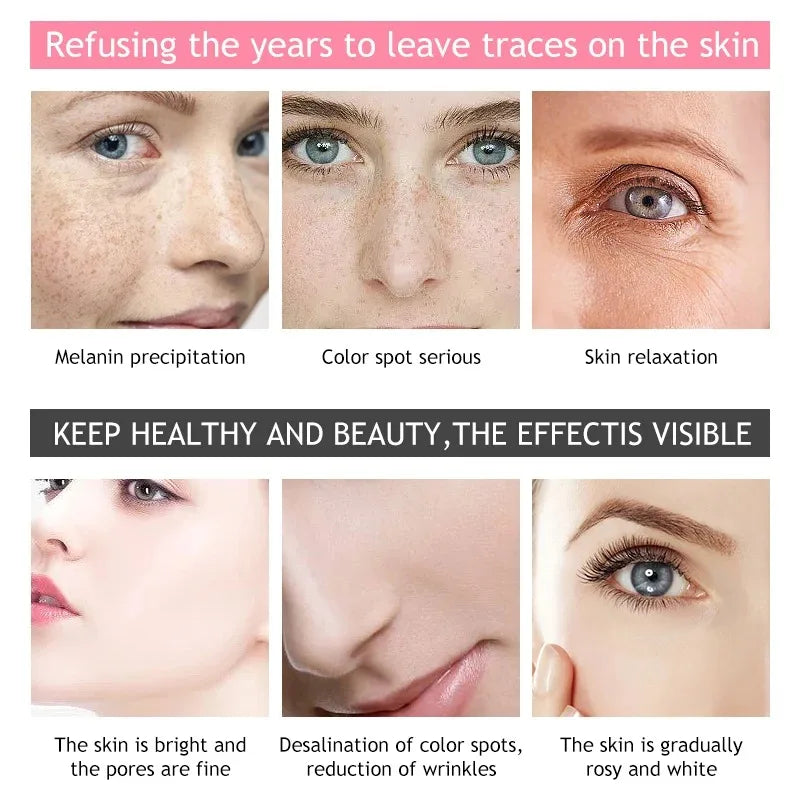 30g Rose Renewing Face Cream Nutritions Anti-Aging Moisturizing Firming Dark Spots Rose Brighten Essence Whitening Beauty Health