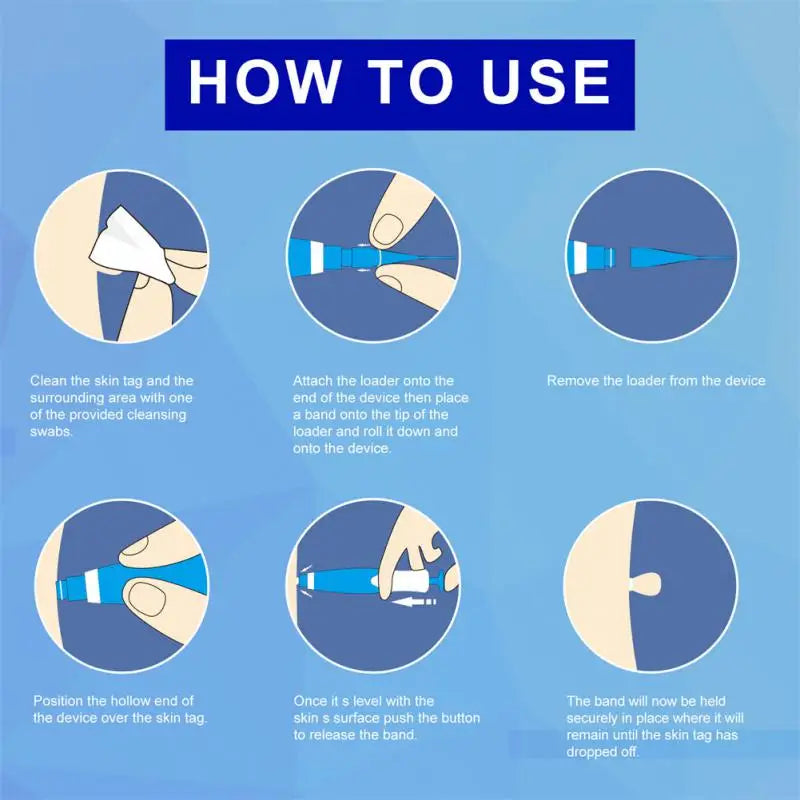 2 In1 Painless Auto Skin Tag Mole Wart Removal Kit Cleaning Tools Face Skin Care Body Wart Dot Treatments Remover Beauty Health