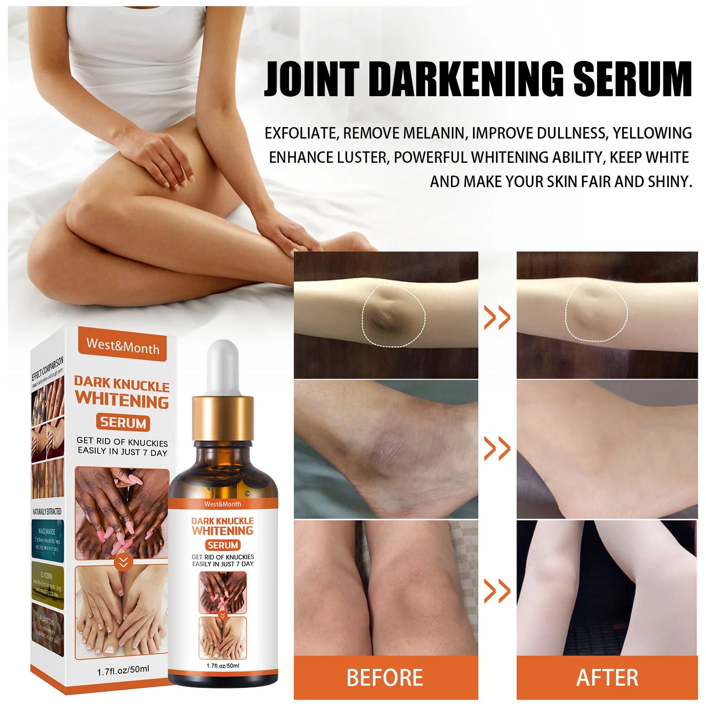 Skin Beauty Essence Lighten Skin Tone Removal Elbows Knee Melanin Dark Knuckle Reduce Dullness Moisturizing Brightening Serum