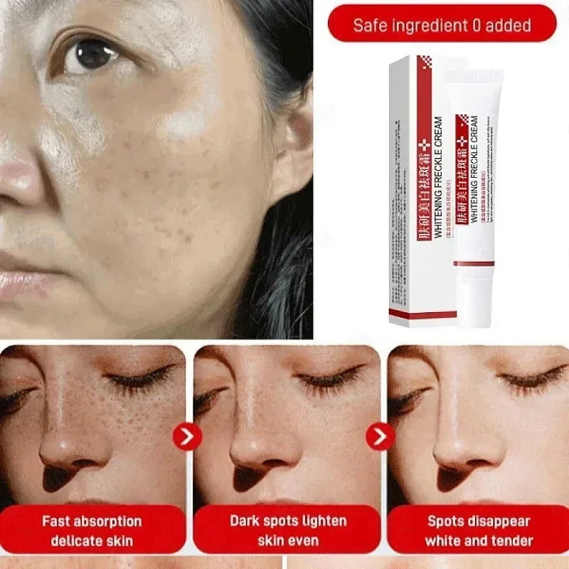 Face Melasma Cream Brightening Dark Skin Remove Black Dots Lightening Melanin Brighten Cream For Dull Skin  Moisturizing Product