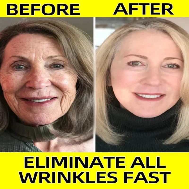 Anti-aging Serum Neck Wrinkle Remover Face Lines And Wrinkles For Women Anti Age Collagen Boost Skin Products Beauty And Health