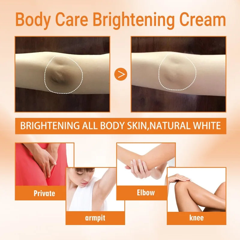 Brightening Cream For Intimate Parts Body Knees Remove Dull Pigments Brighten Serum Elbows Knuckles Lightening Skin Care Product