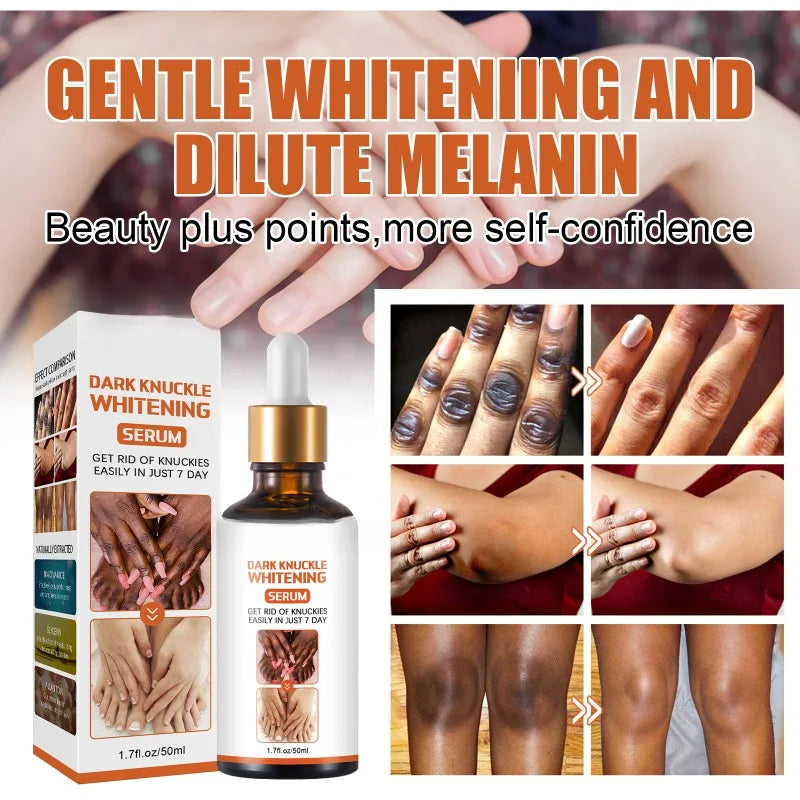 Skin Beauty Essence Lighten Skin Tone Removal Elbows Knee Melanin Dark Knuckle Reduce Dullness Moisturizing Brightening Serum