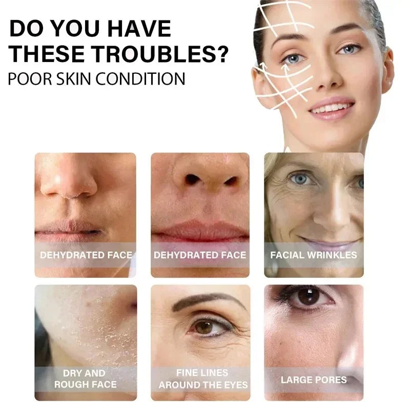 Collagen Protein Thread Instant Wrinkle Remover Serum Set Lifting Firming Soluble Absorbable Face Filler Anti-aging Skin Care