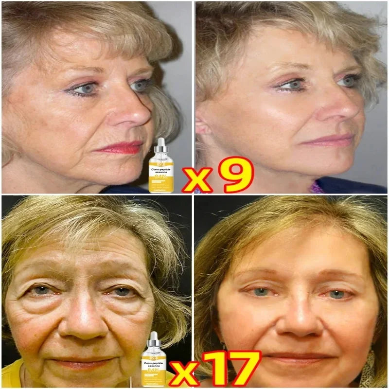 Anti-aging Serum Neck Wrinkle Remover Face Lines And Wrinkles For Women Anti Age Collagen Boost Skin Products Beauty And Health